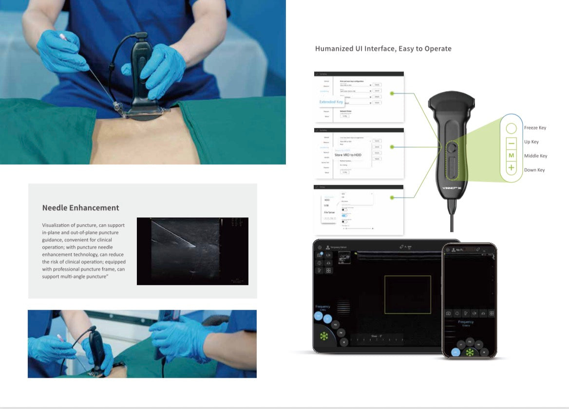 Vinno Q+ hand-held Ultrasound