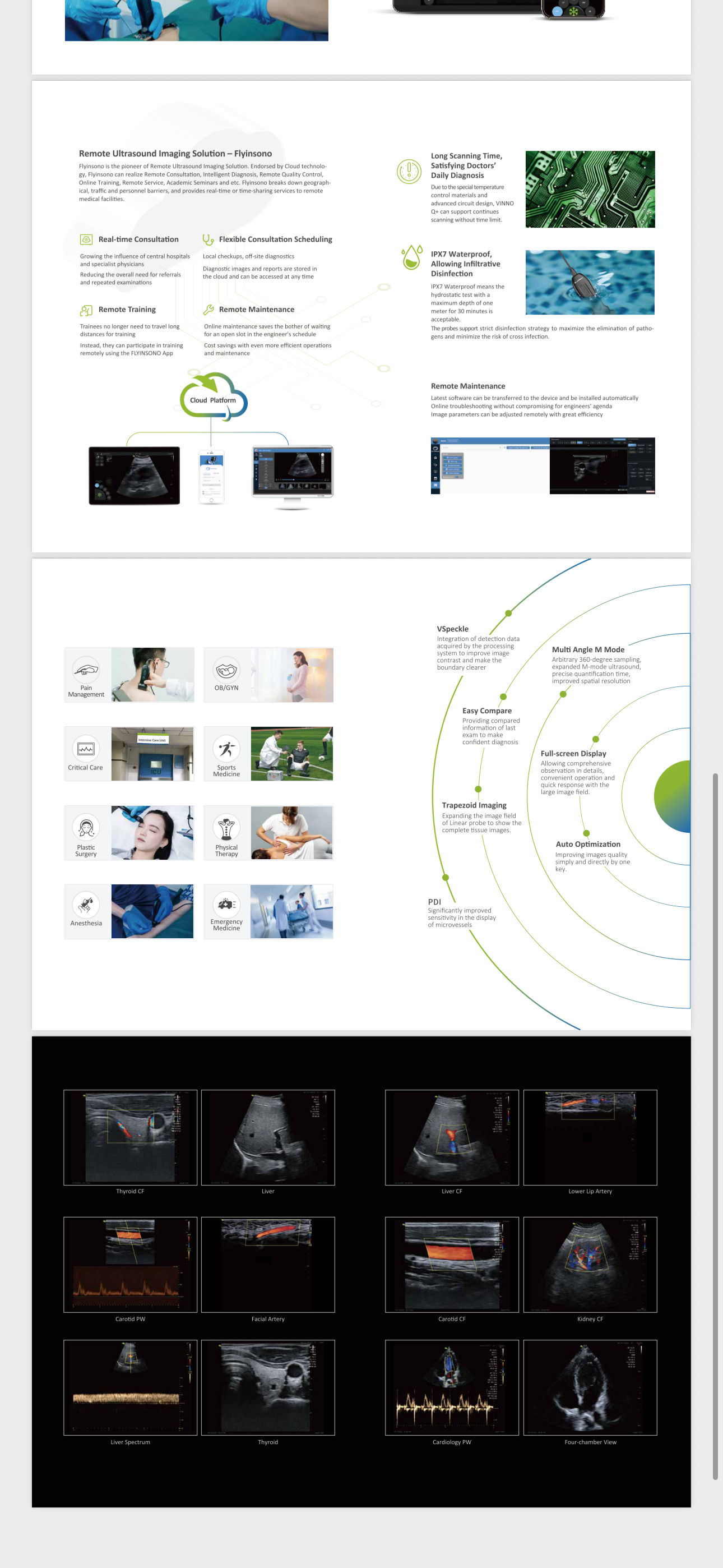 Vinno Q+ hand-held Ultrasound