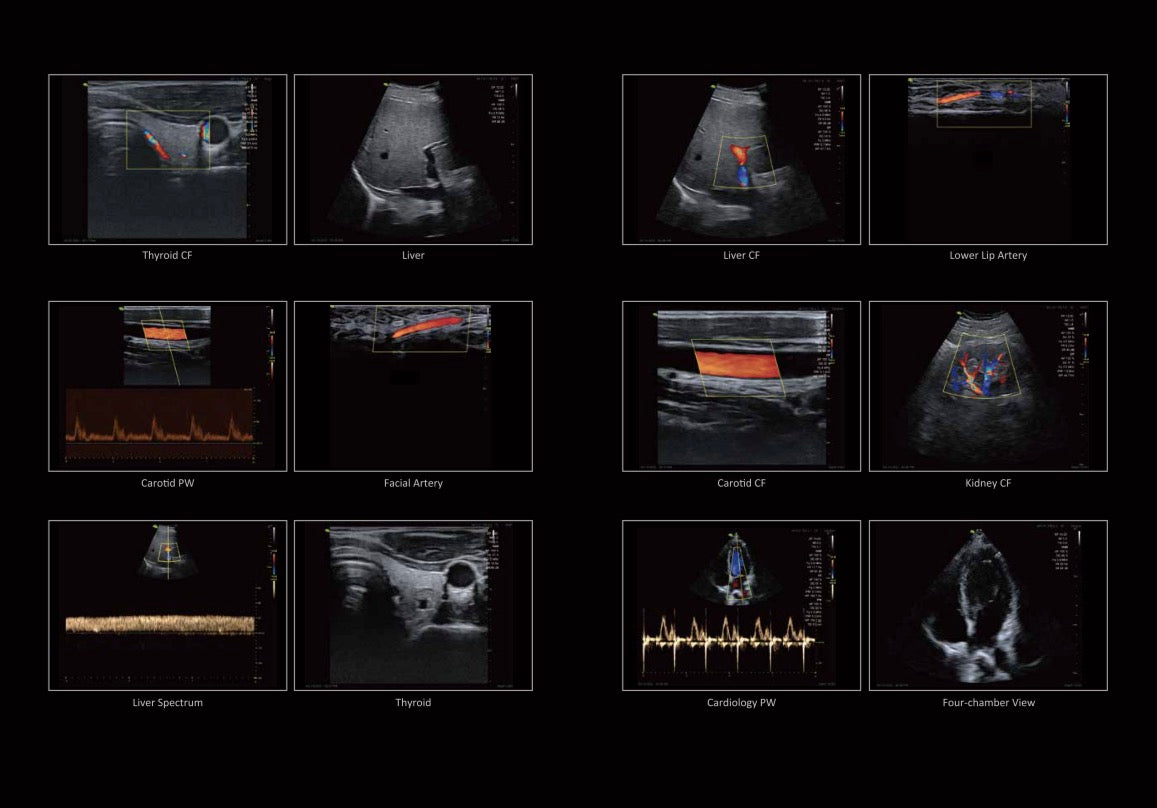 Vinno Q+ hand-held Ultrasound