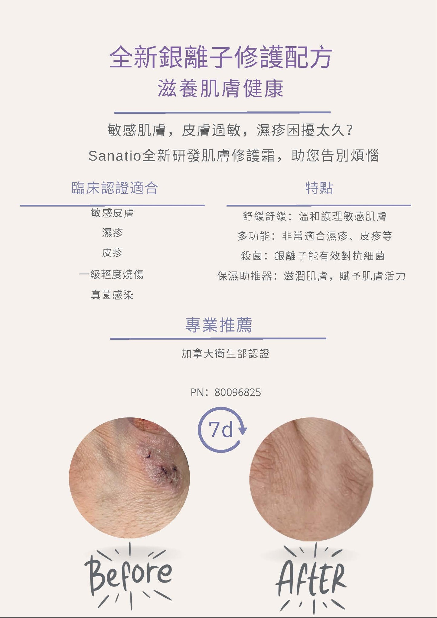Sanatio 皮膚修護霜 (2025年12月到期）